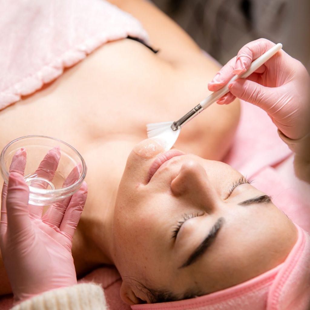 tratamiento-de-peeling-quimico-palma