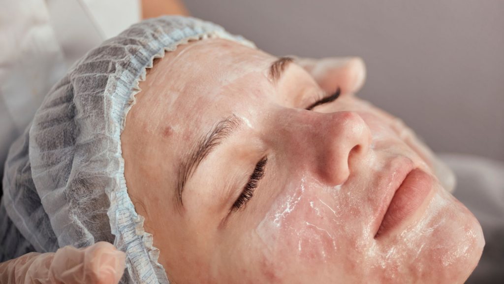 acne-limpieza-facial