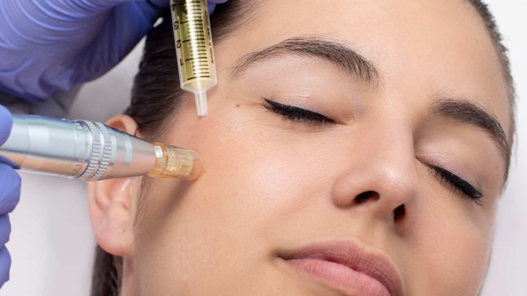 tratamiento-facial-con-exosomas-mallorca