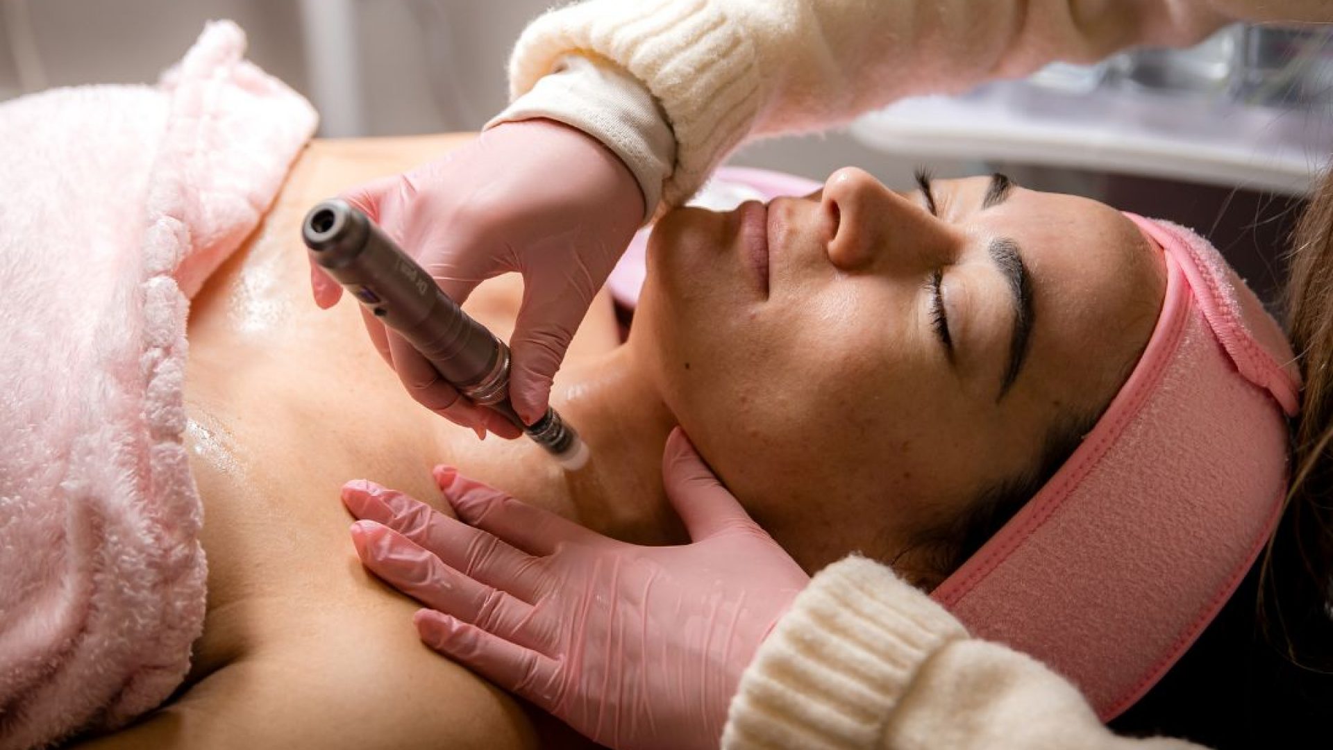 microneedling-palma-de-mallorca