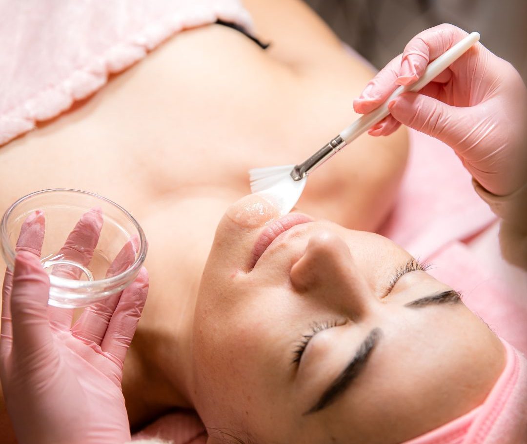 tratamiento-de-peeling-quimico-palma